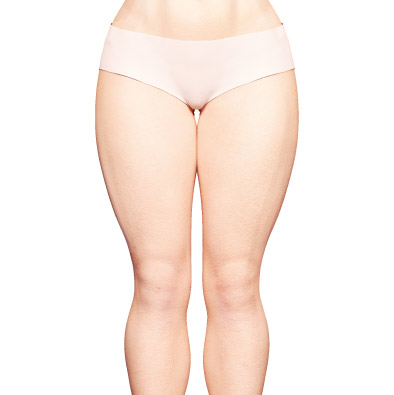 Обширные и локальные жировые отложения, нарушающие пропорции тела